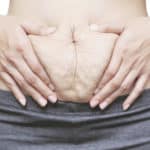 Schwangerschaftstreifen und Hautunreinheiten: Welche Pflege braucht die Haut nach der Schwangerschaft?
